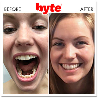 byte teeth customer service