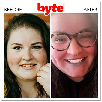 byte before after dannie