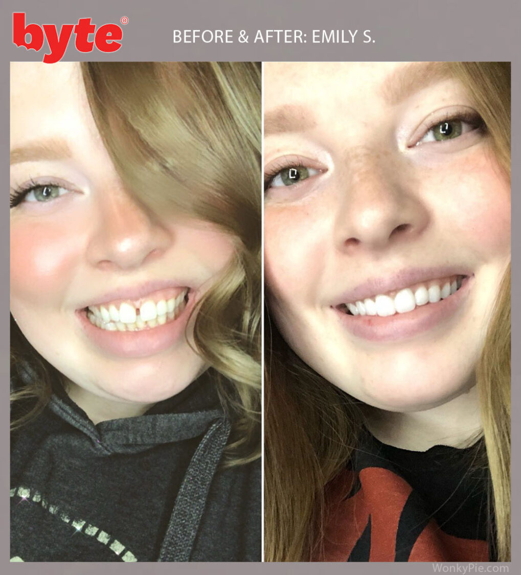byte before after emily
