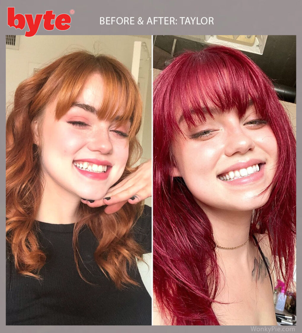 byte before after taylor