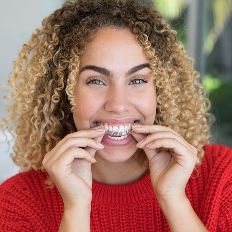 byte clear aligners