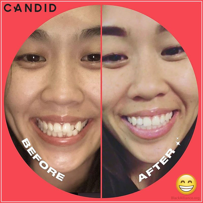 candidco before after justyne